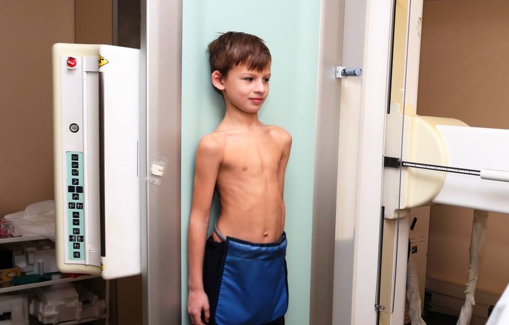 Рентген плечевого сустава ребенку