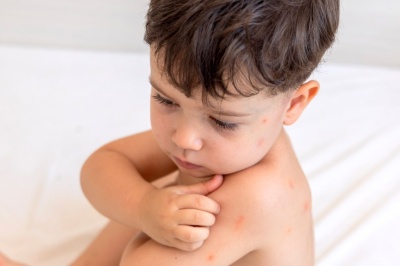 Пищевая аллергия у детей